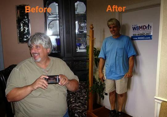 W8MD patient weight loss success story