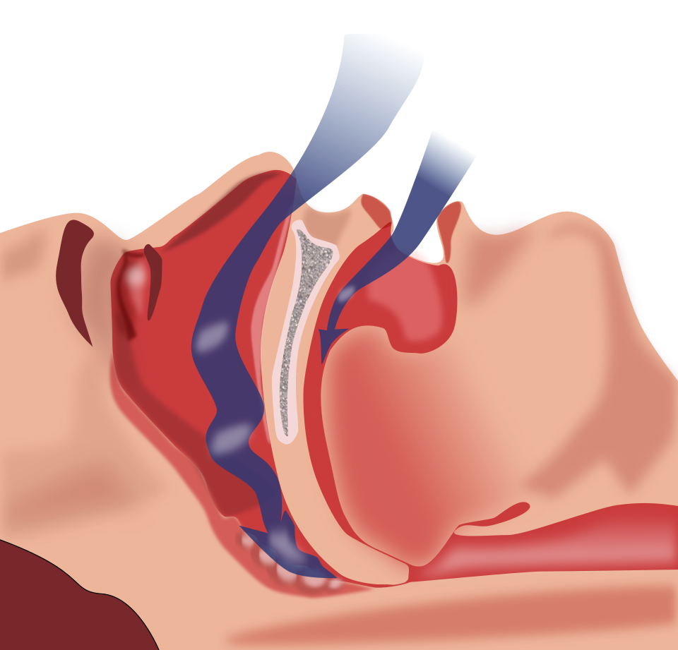 Circadian rhythm sleep-wake disorders — W8MD medical team and health resource
